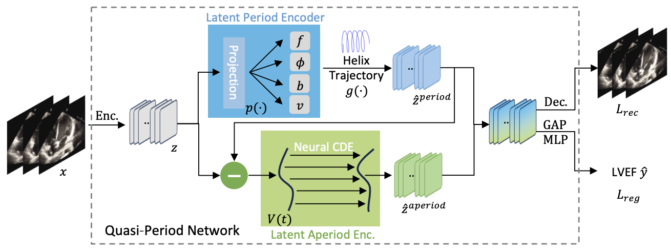 Q-PART: Quasi-Periodic Adaptive Regression with Test-time Training for Pediatric Left Ventricular Ejection Fraction Regression 